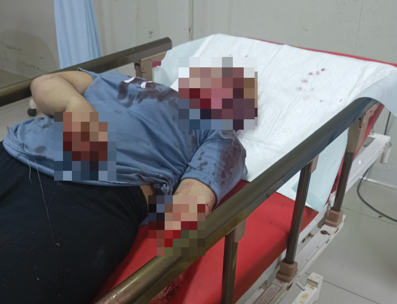 Diduga Berawal dari Putus Hubungan, Polisi Dalami Motif Insiden Berdarah di Kijang Mas