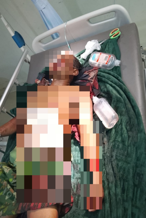 Duel Berdarah di Rumah Pengepul Besi Rongsokan, Perampok Ditangkap Warga Usai Kejar Saksi